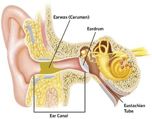 Ear Candling Diagram